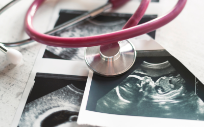 Ultrasound photos and stethoscope